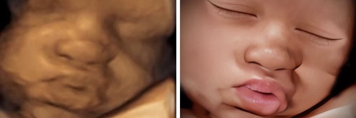 MiracleWomb's profile banner image
