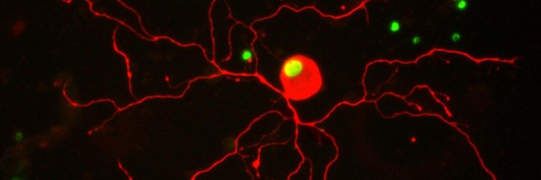 Dr Jess Chadwick banner