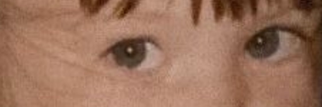 E. banner