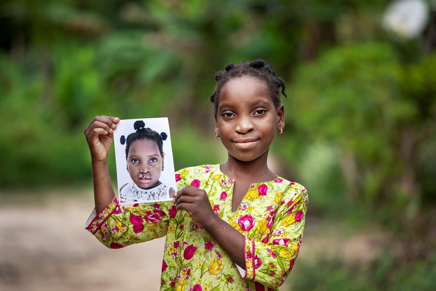 Operation Smile South Africa banner