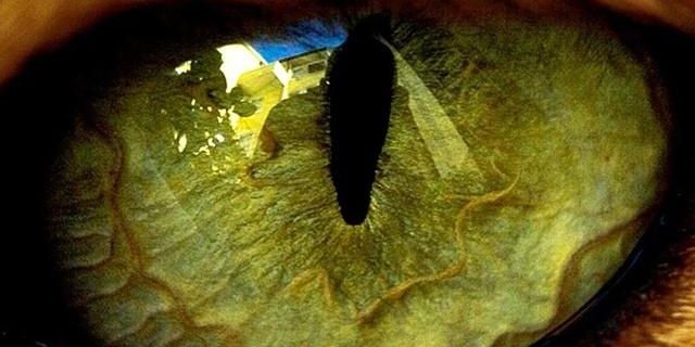 Harold Cunningham banner