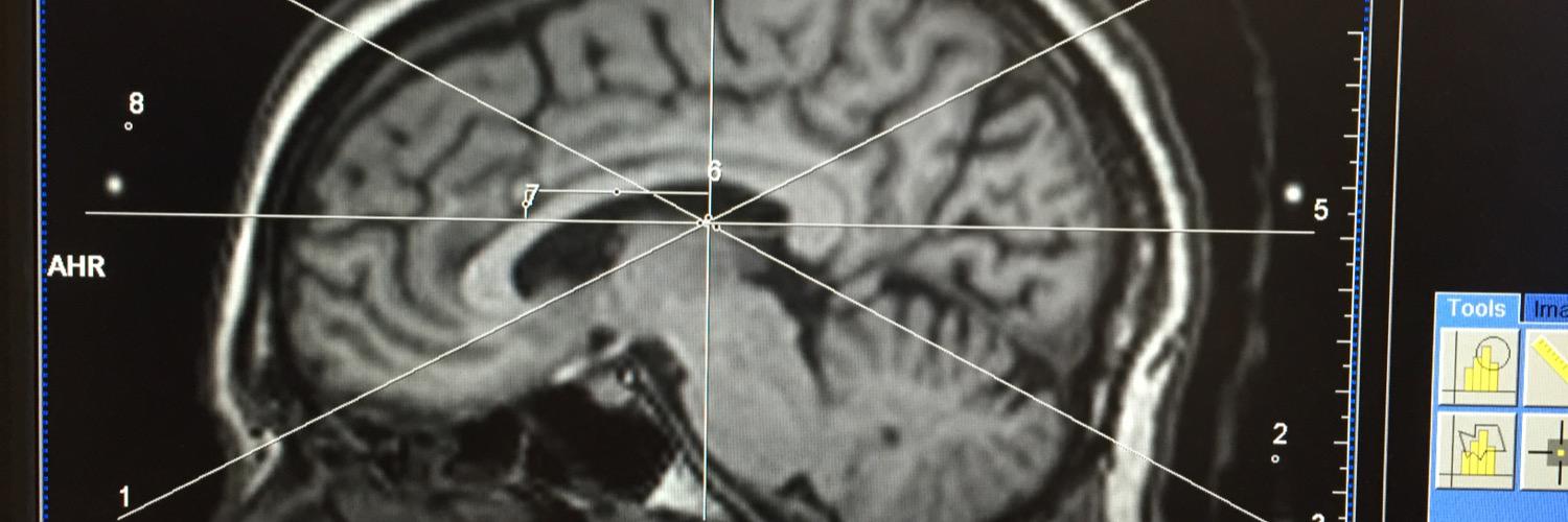 Arthur André banner