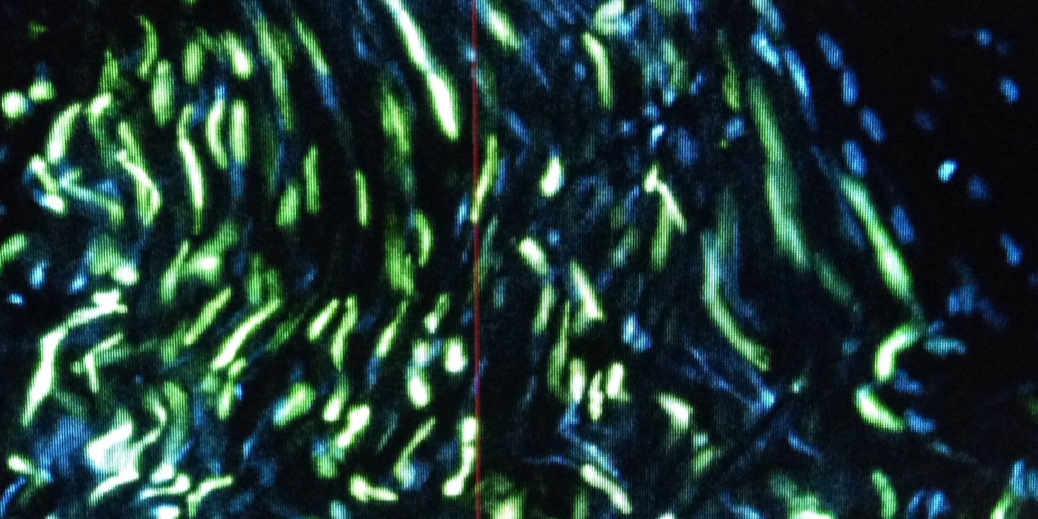 Mor Grinstein banner