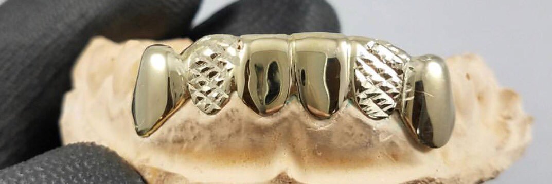 Fred Bennett Jr (@206goldgrills) / Posts / X