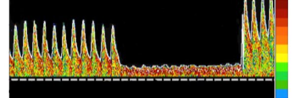 deepak_neuro Profile Banner