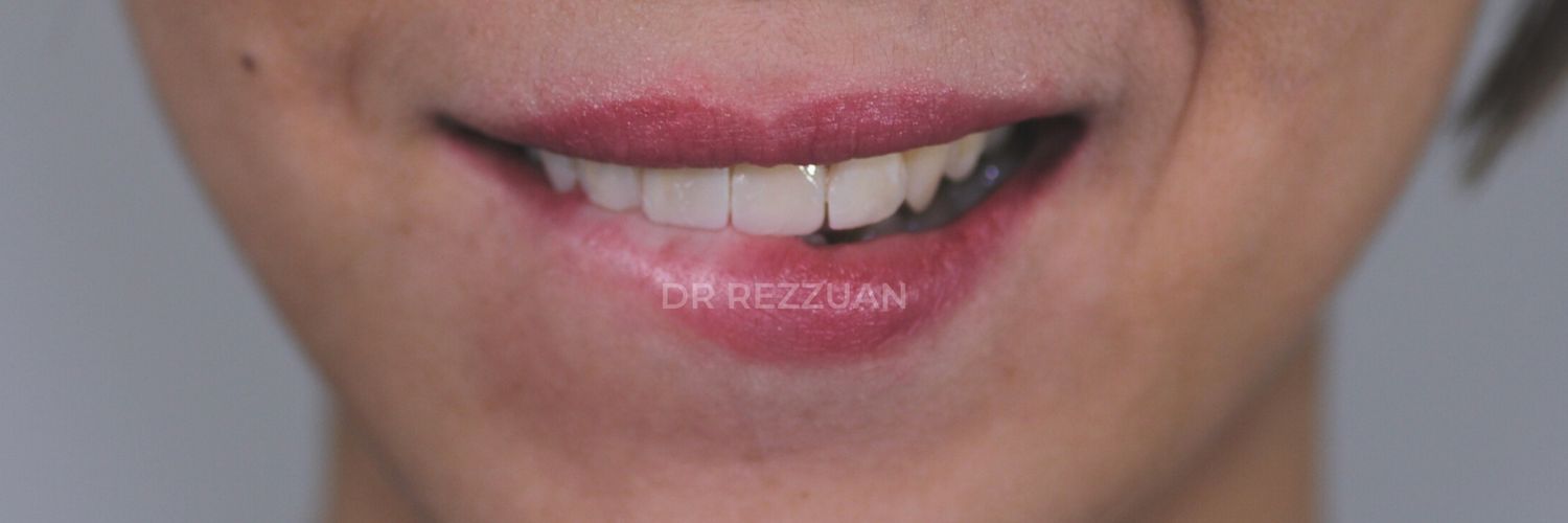 RezzuanRahim's profile banner image