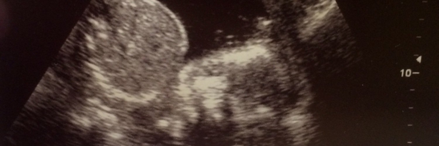 ki_mal_'s profile banner image