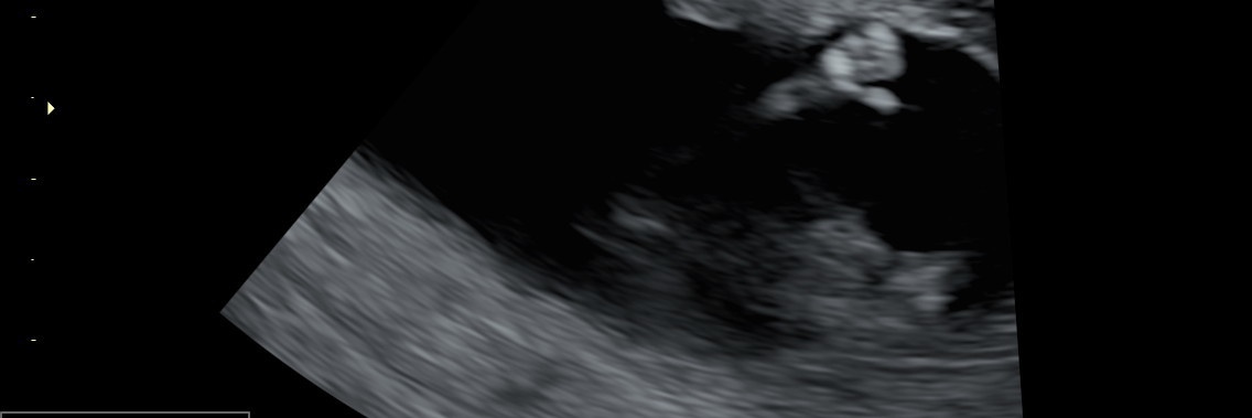 tmanncxc15's profile banner image