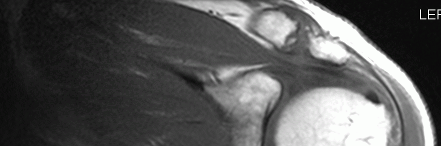 Eric Chaconas PT PhD banner