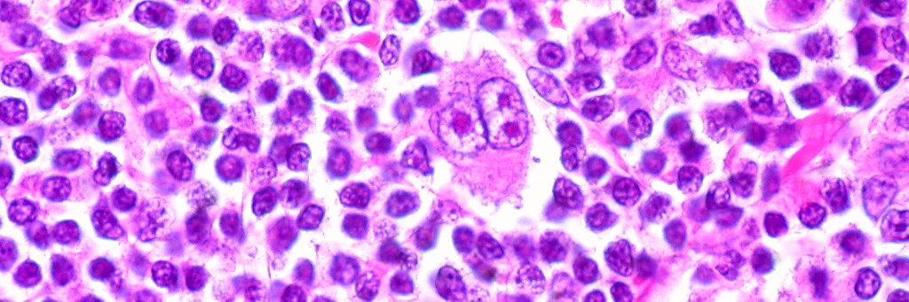 Akiva Diamond banner