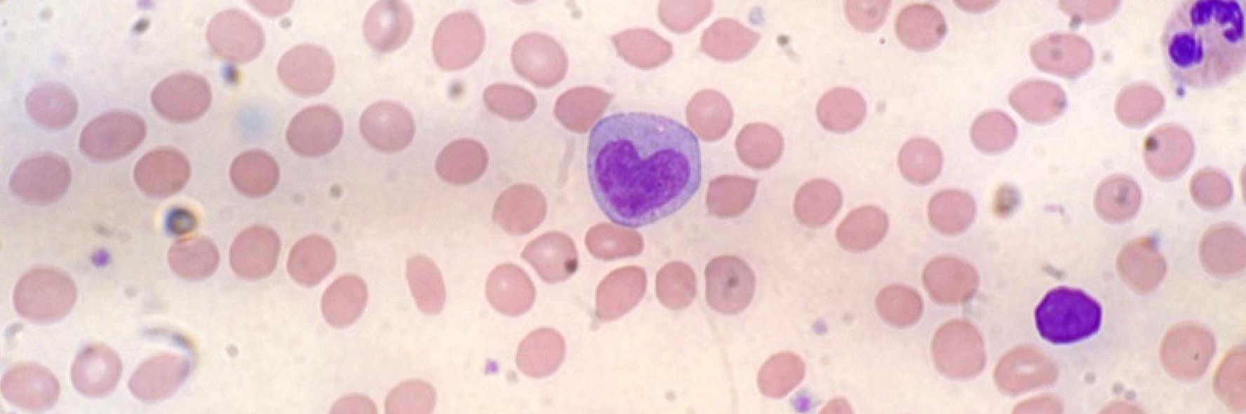 Caroline Watson banner