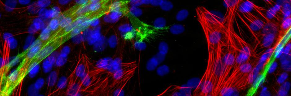 Warren Grayson banner