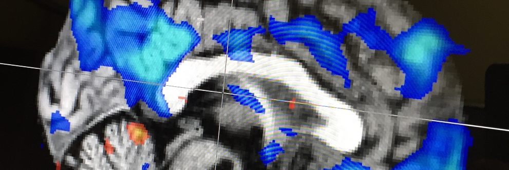 Stuart Sherman banner