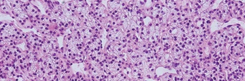 _homoglobin's profile banner image