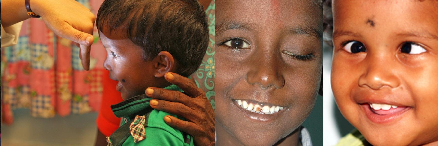 AravindEyeFdtn banner