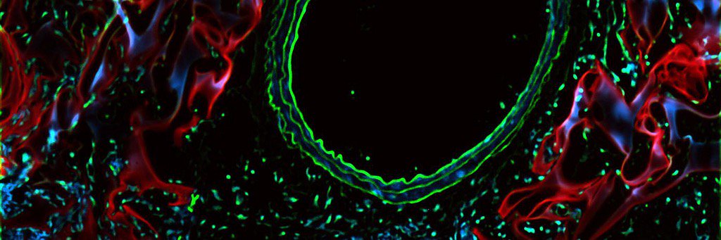 Harvard-MIT BMEC banner