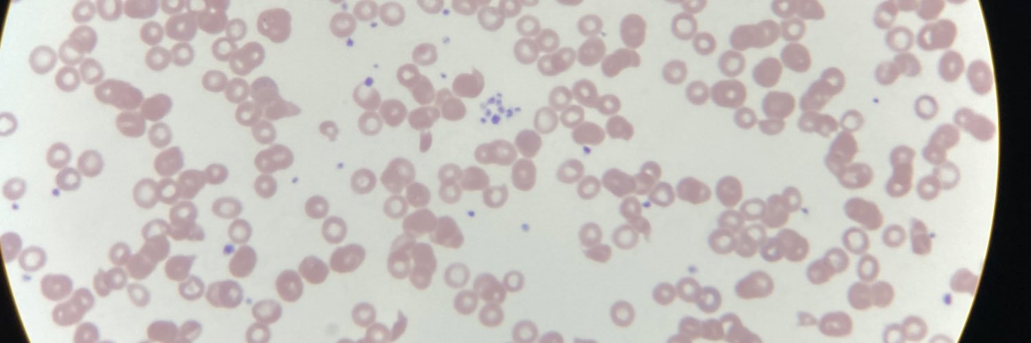 Jacob Appelbaum banner