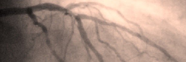 ACSTrials's profile banner image
