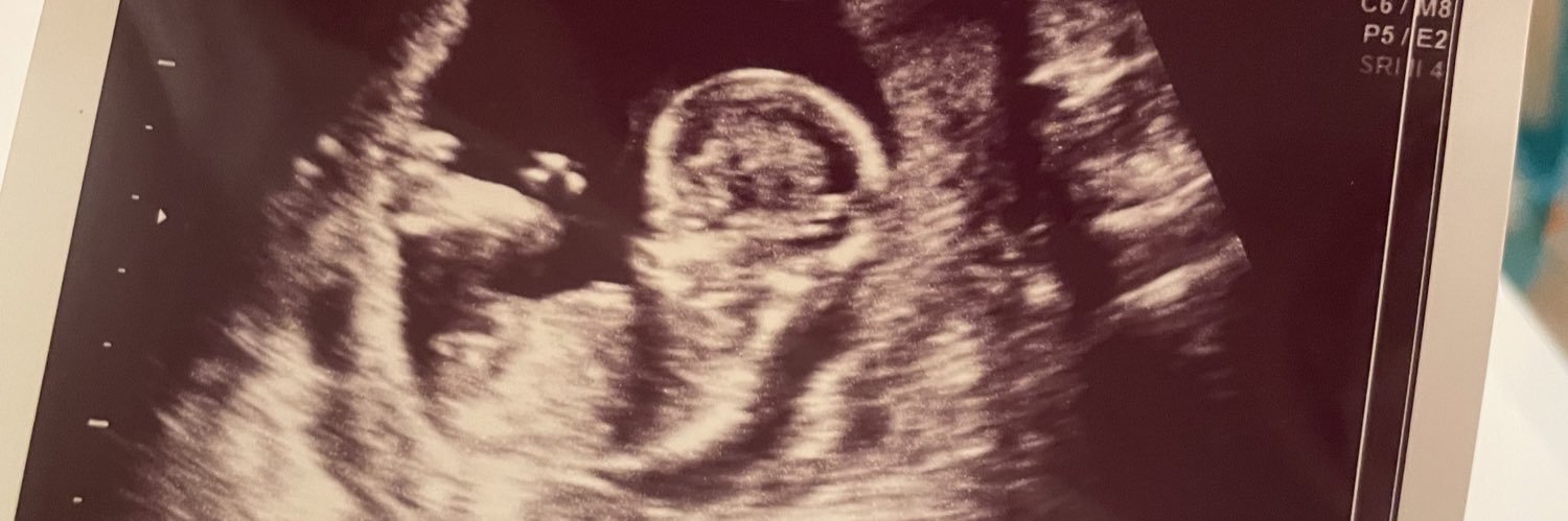 hallodesiree10's profile banner image