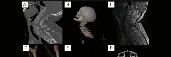 PelvicFlour Profile Banner