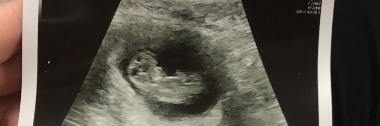 TylerSloan3's profile banner image
