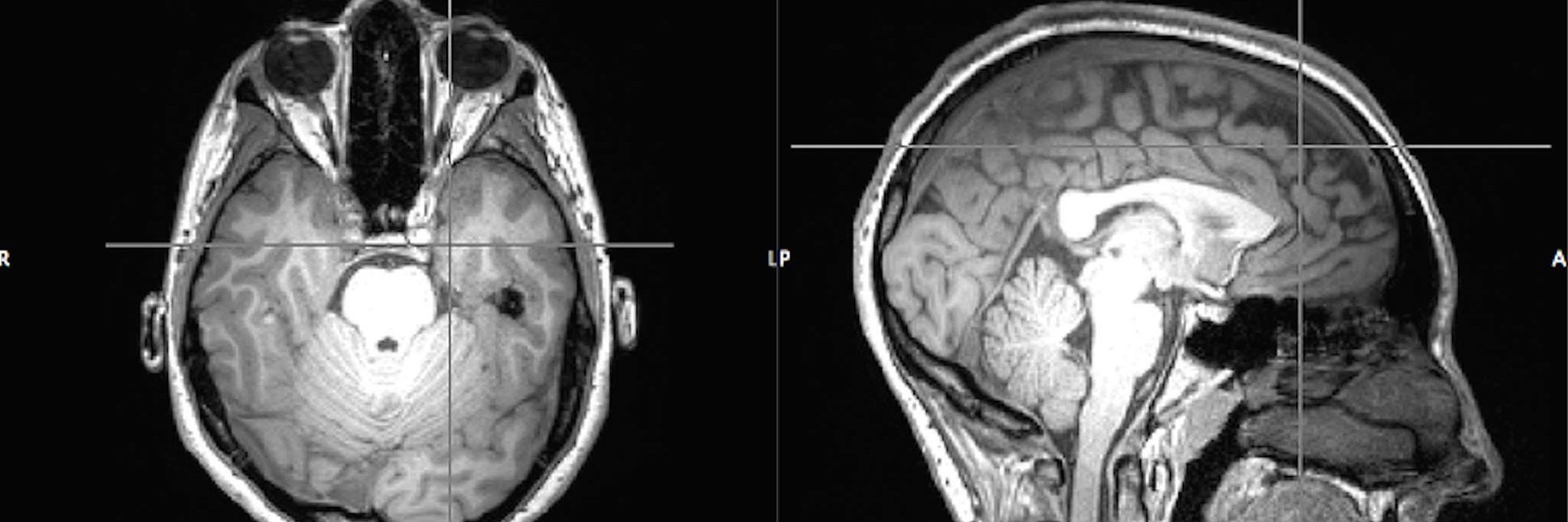 Katherine Rae Mondo banner