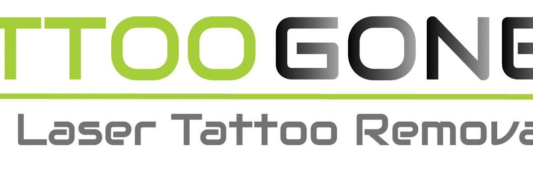 TattooGoneKent's profile banner image