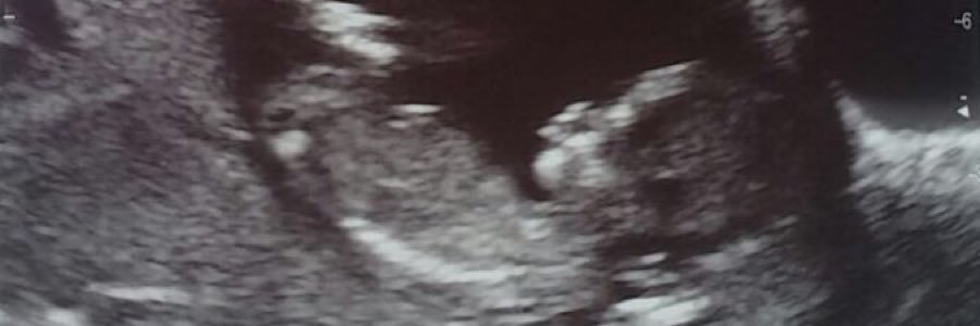 Raymonde_mc's profile banner image