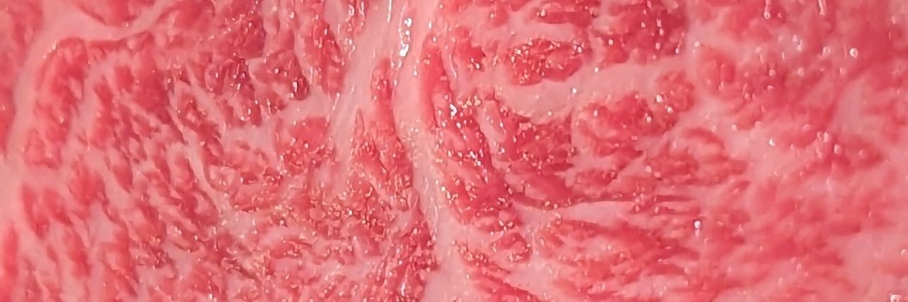 半月板損傷's banner