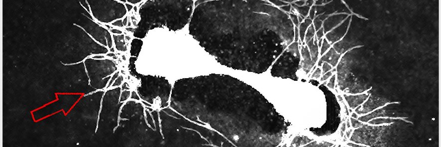 Gülce Perçin's banner