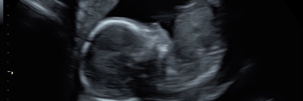 MccarterCameron's profile banner image