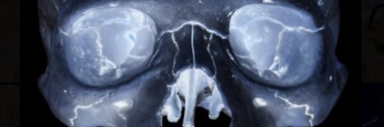 P. Grey Ham Branton banner
