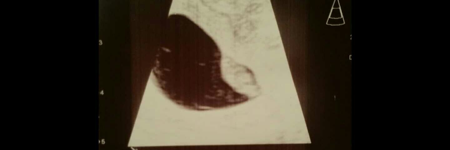 Pray4Pregnancy's profile banner image
