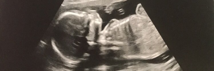 bethrudkin99's profile banner image