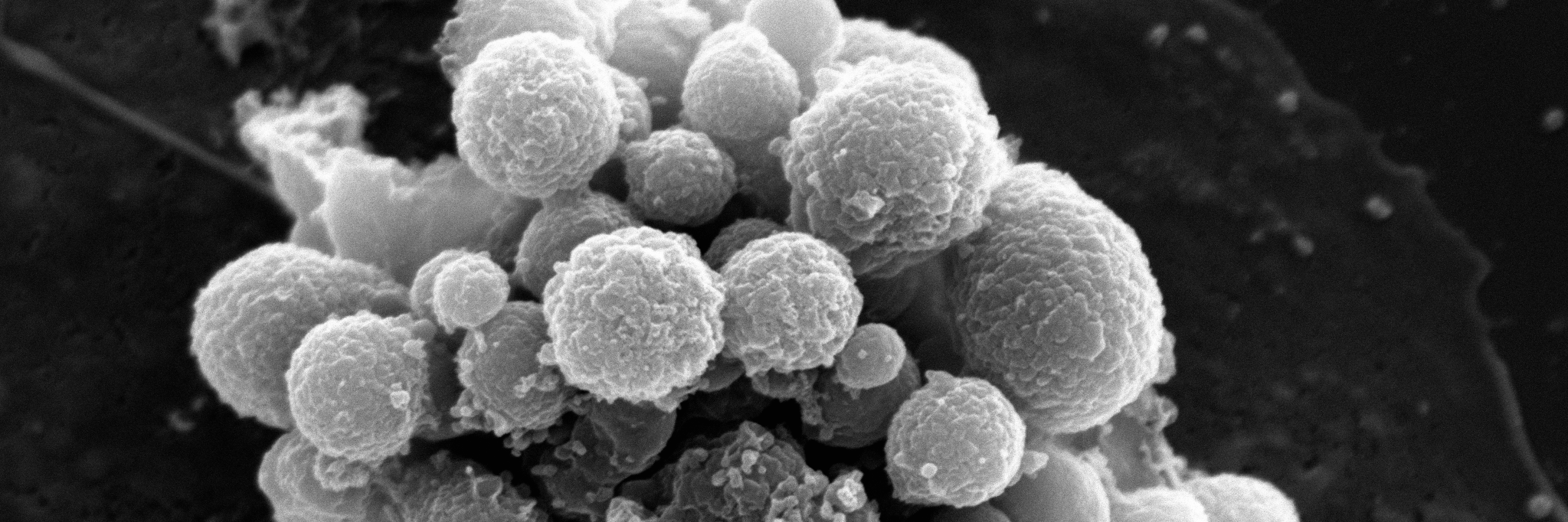 Small GTPases banner