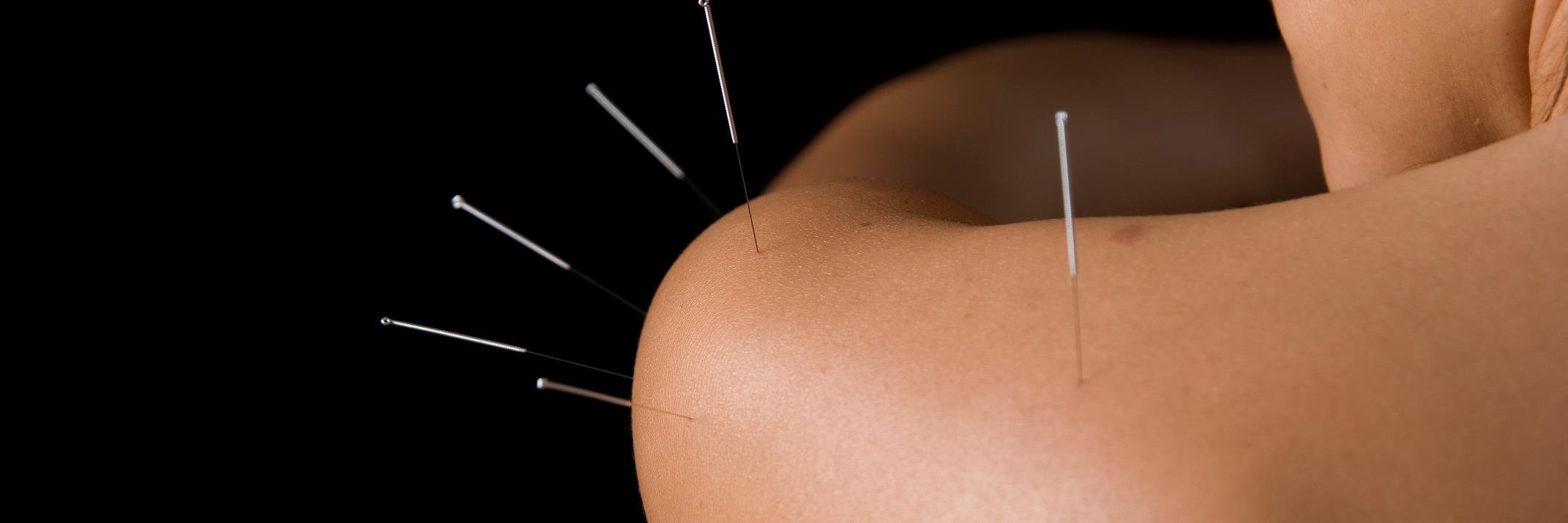 acupunctureTrad's profile banner image