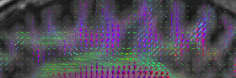 diffusionmri's profile banner image