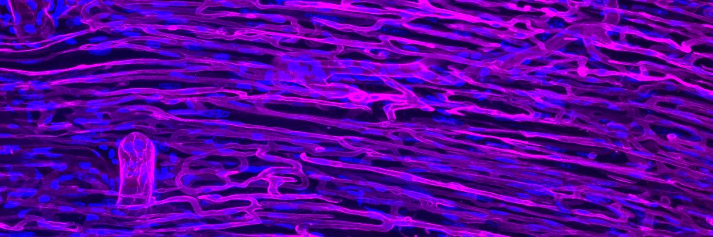 Galen Squiers banner