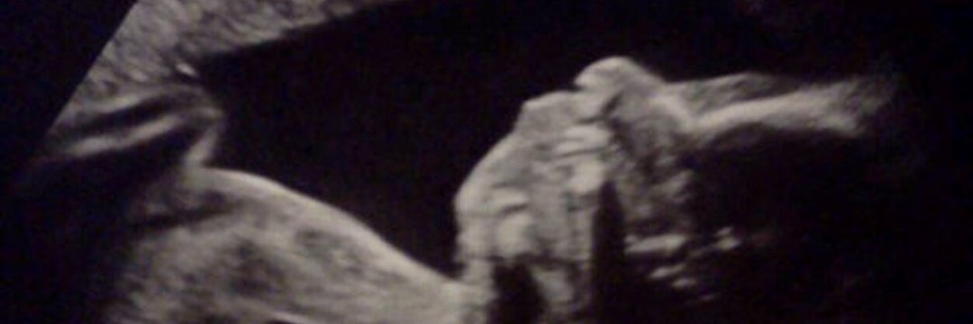 Angericon's profile banner image
