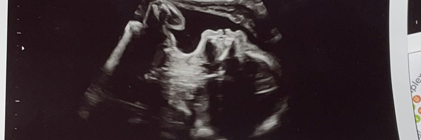 jillbeanenix's profile banner image