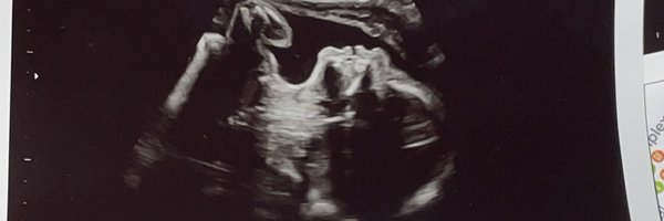 jillbeanenix Profile Banner