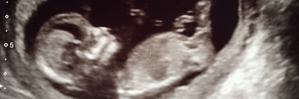 JoshD12's profile banner image