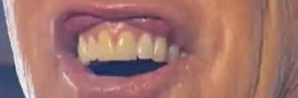 john elways teeth banner