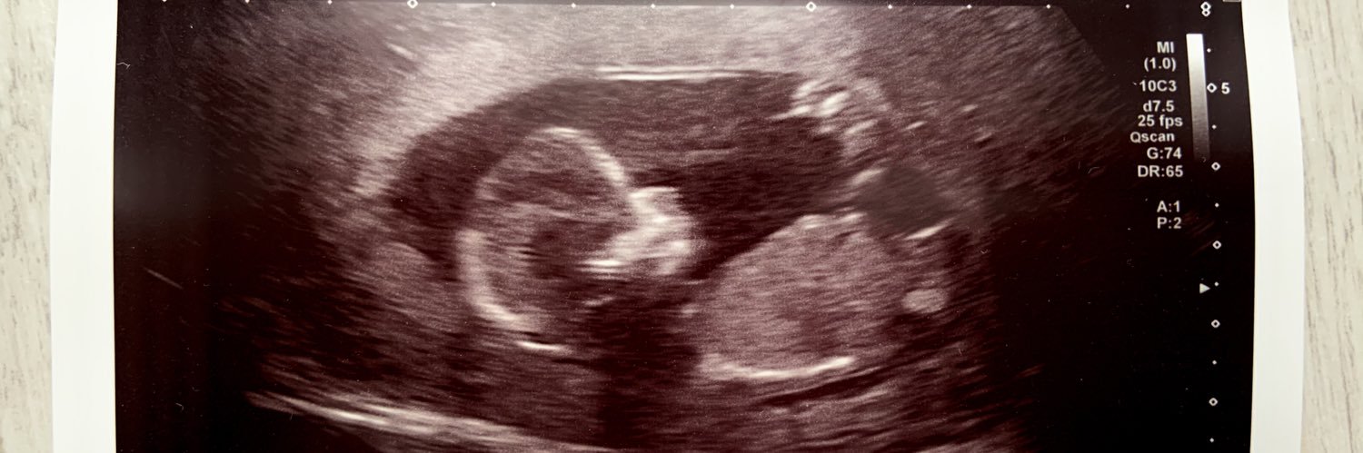 RachelReilly96's profile banner image