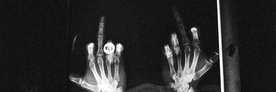 Brendon Dlamini banner