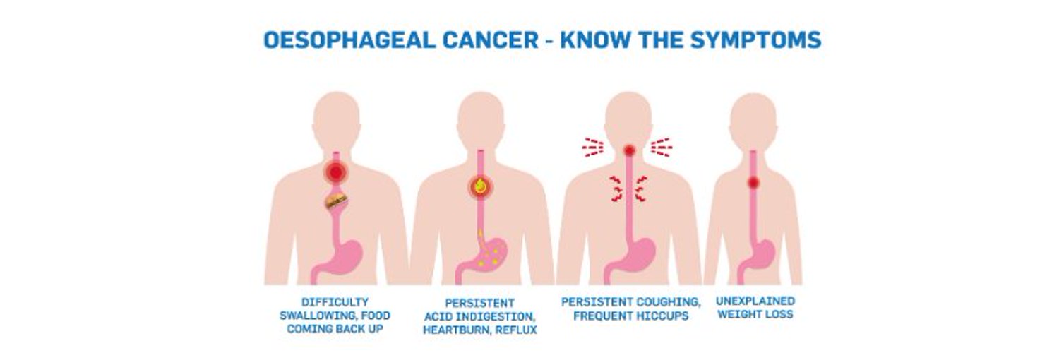 Oesophageal Cancer Fund Profile Banner