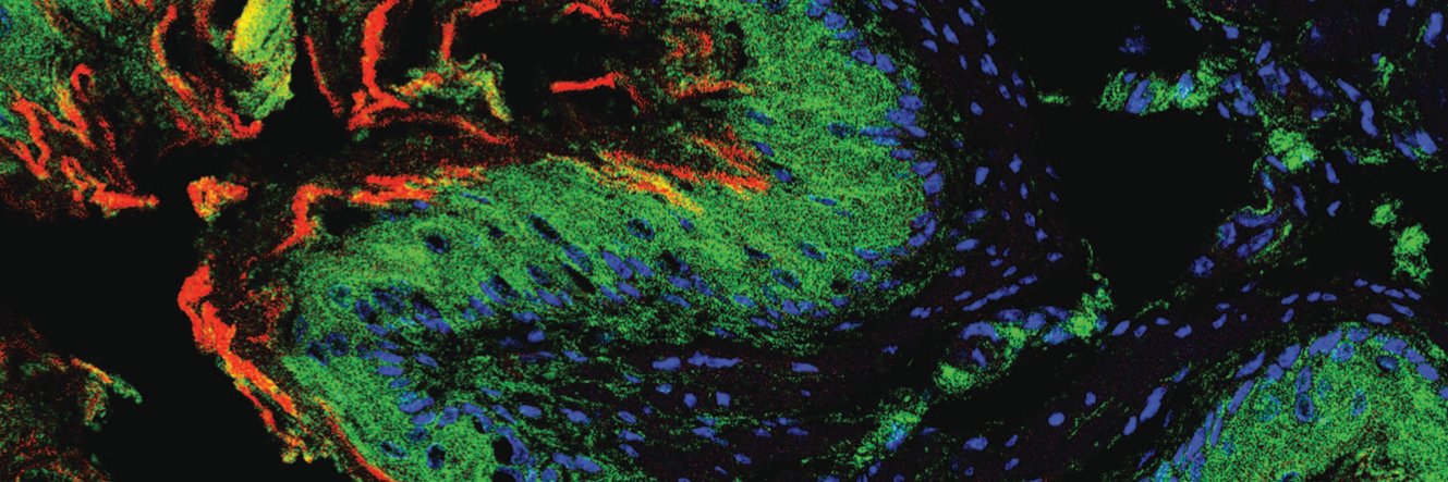 Zander Nguyen banner