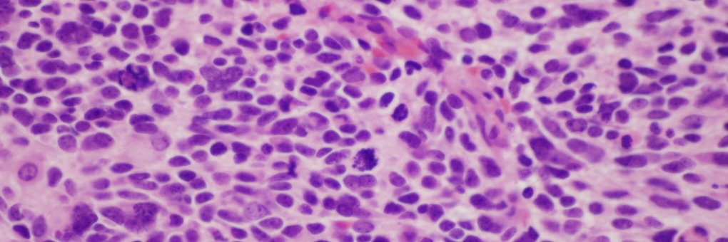 Jason Jarzembowski banner