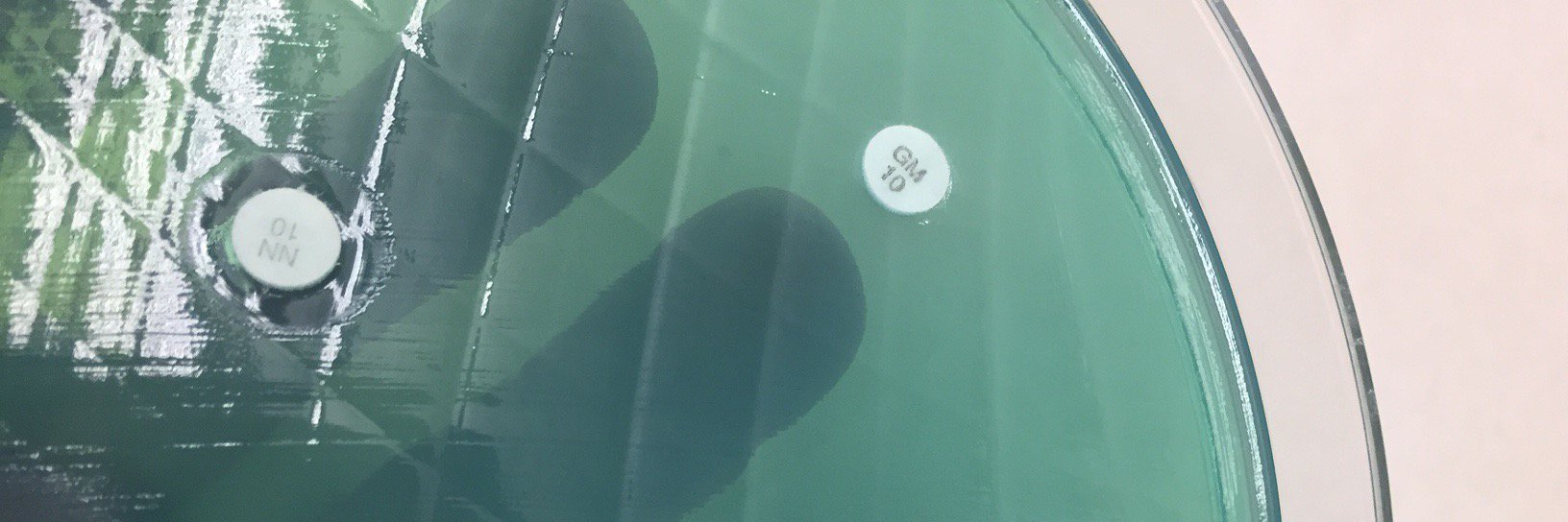 JClinMicro EIC banner