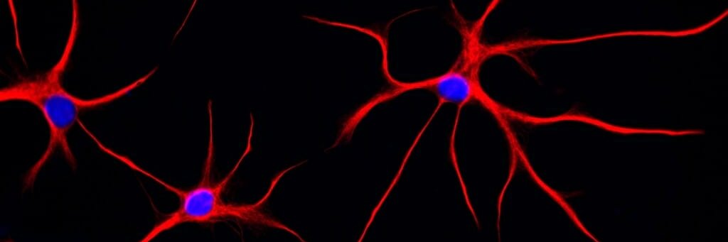 USC Brain Tumor Center (uscbtc)'s banner